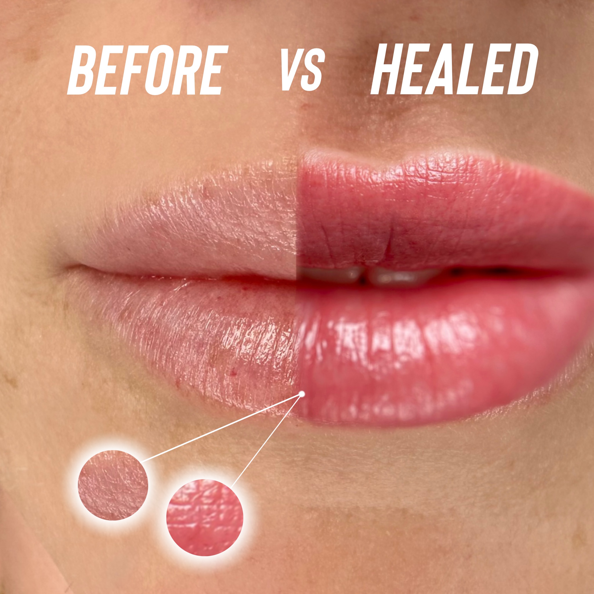 Lip blush before and healed results